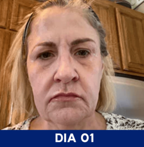 Dia-01.png